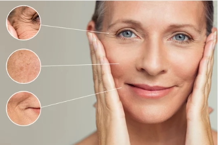 Anti Aging Treatment at Asperia Cosmo Care at Raipur