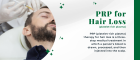 PRP Treatment For hair Loss